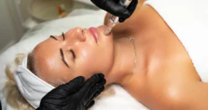 A woman lying on a treatment bed receiving a liquid microneedling facial procedure from a professional in Greenwich, CT