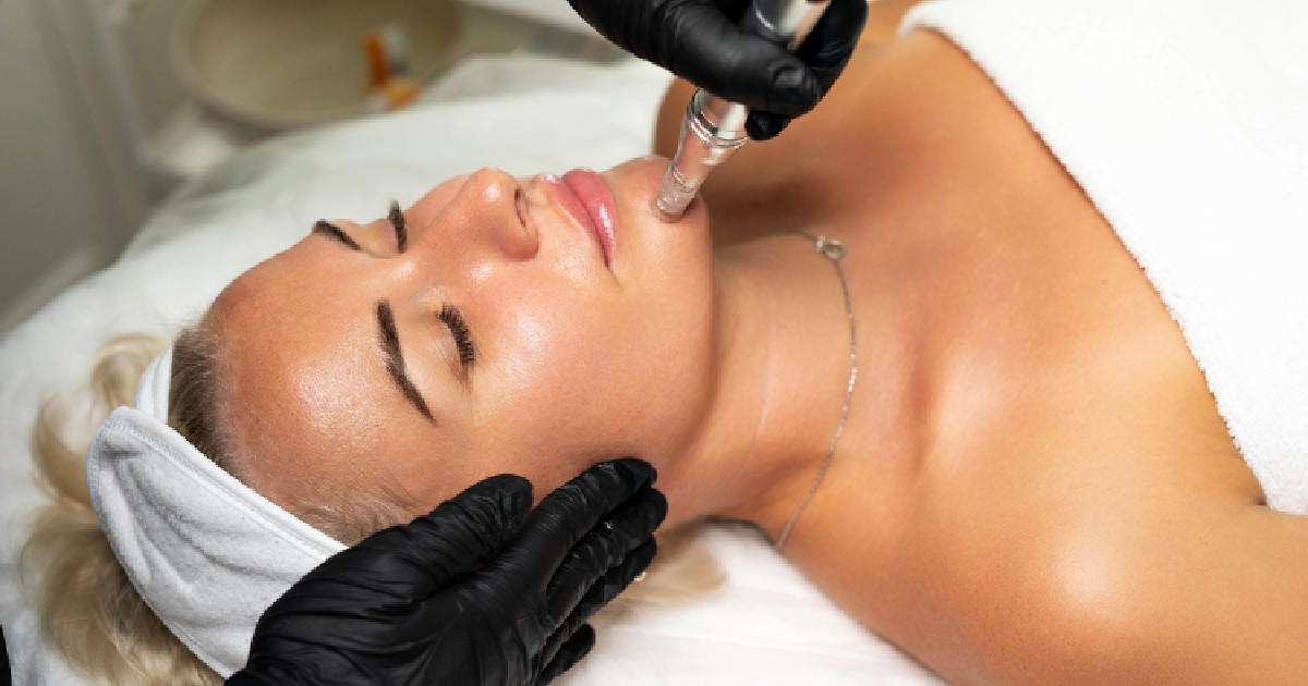 A woman lying on a treatment bed receiving a liquid microneedling facial procedure from a professional in Greenwich, CT