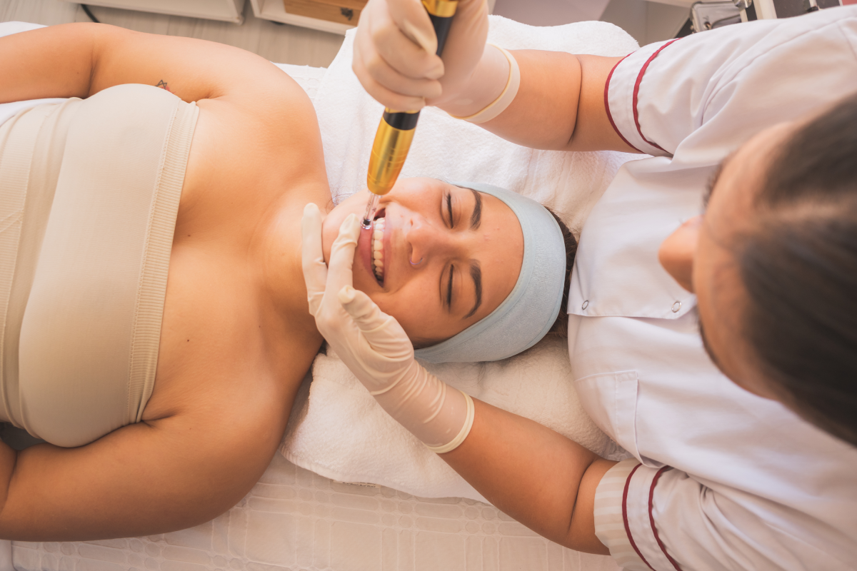 Liquid Microneedling in Greenwich, CT