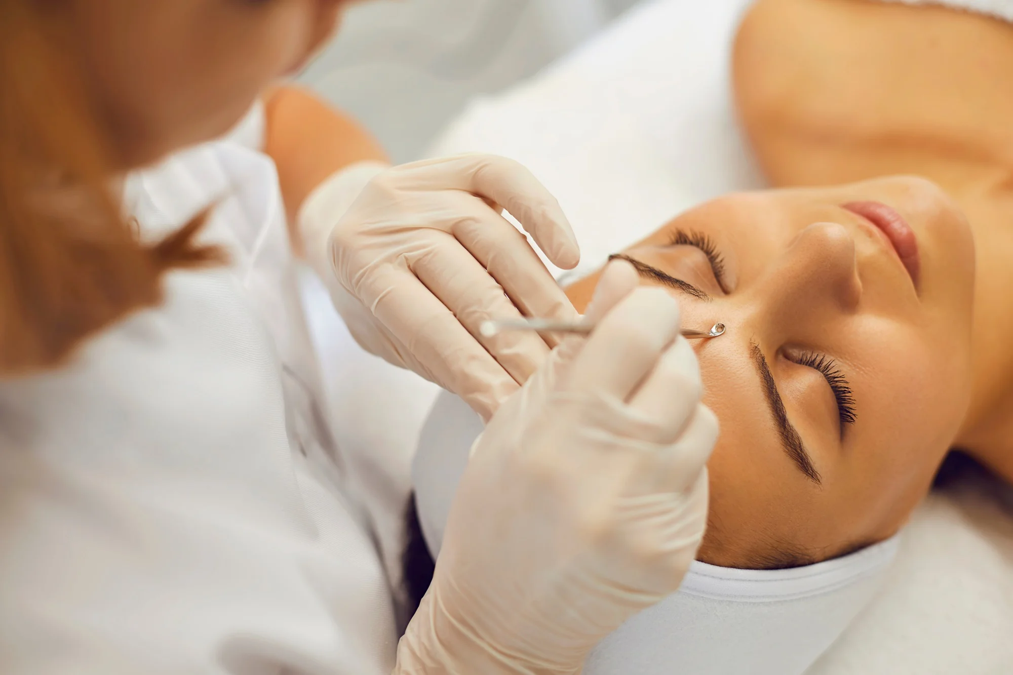 nicolecaroline milia removals treatmentl in Greenwich CT | Services