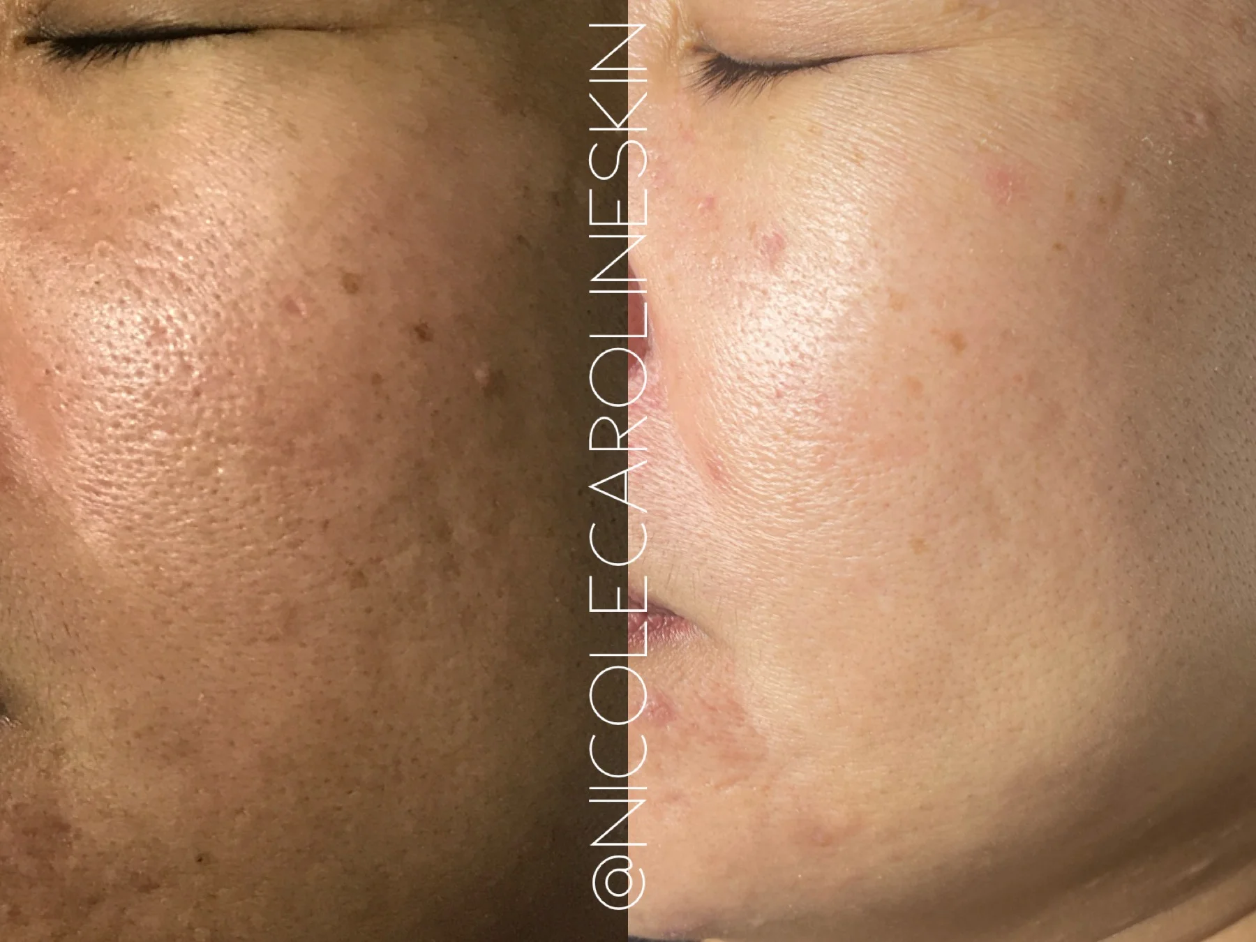nicolecaroline result i in Greenwich CT | Results