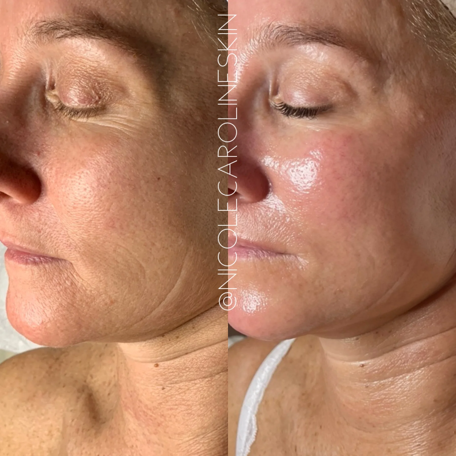 nicolecaroline result j in Greenwich CT | Results