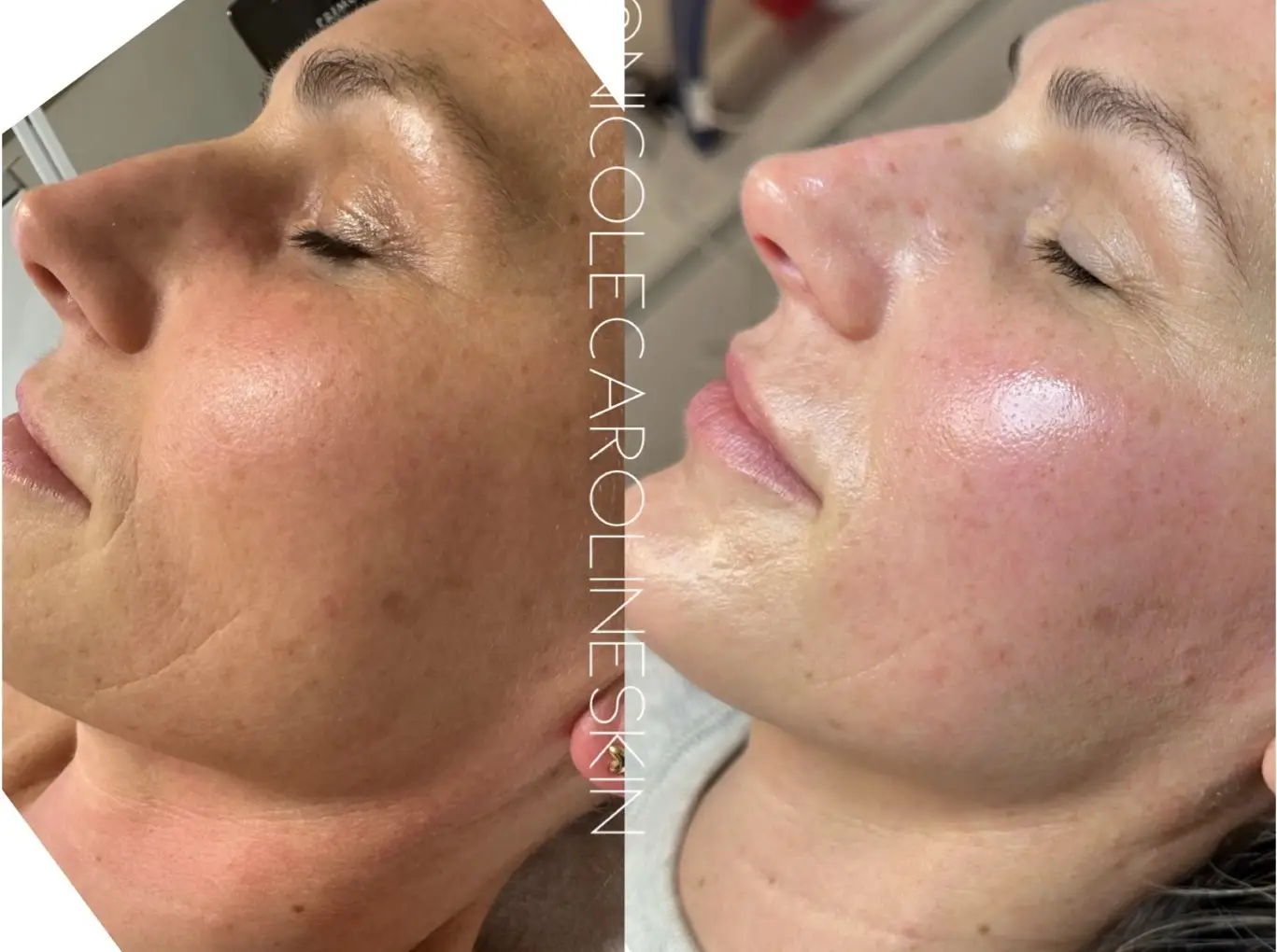 nicolecaroline result l in Greenwich CT | Results