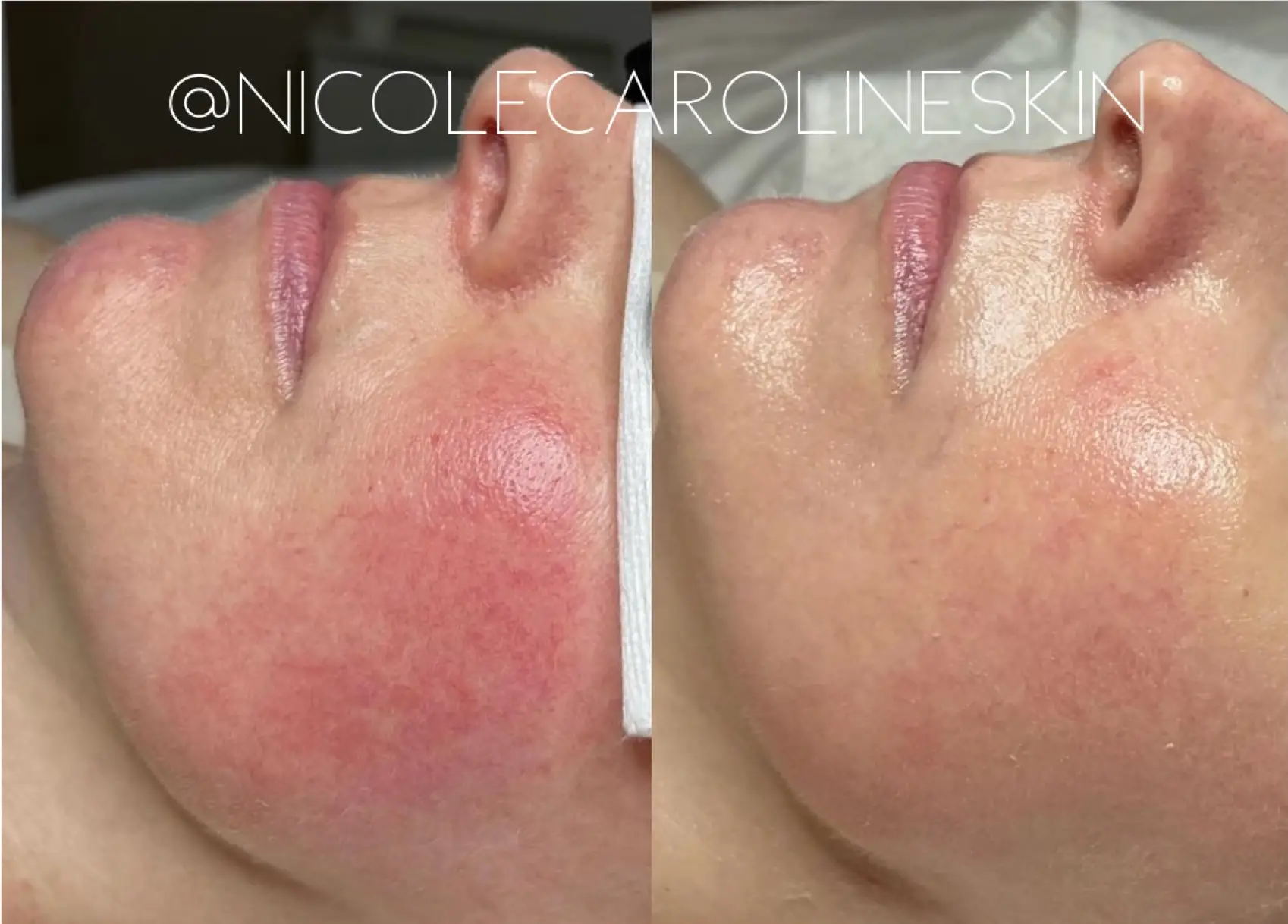 nicolecaroline result n in Greenwich CT | Results