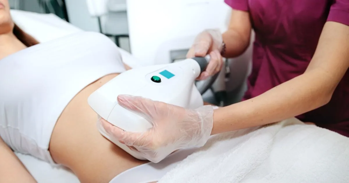 Non-invasive body sculpting treatment area on the stomach for reducing stubborn fat deposits.