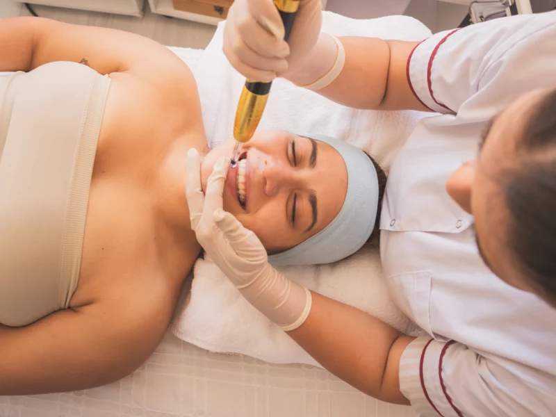 Liquid Microneedling in Greenwich, CT